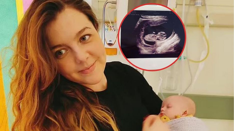 Radzili jej aborcję. Urodziła córeczkę z zespołem Downa