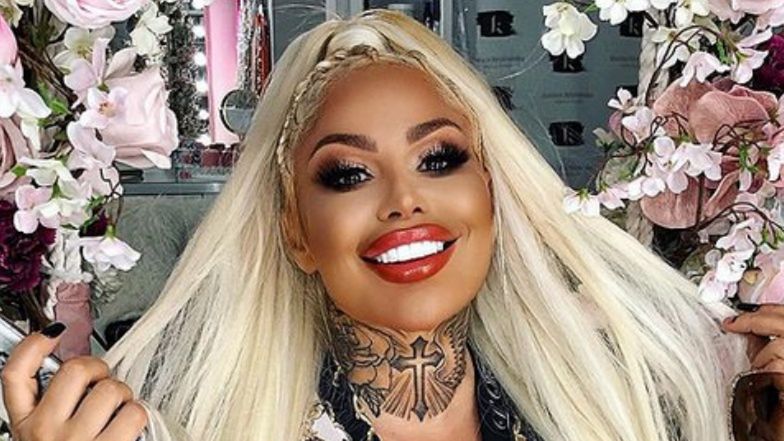 Laluna Unique zachwala efekty ostatnich operacji plastycznych