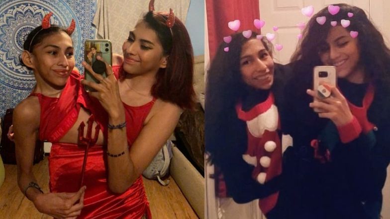 Bliźniaczki syjamskie opowiadają o życiu miłosnym