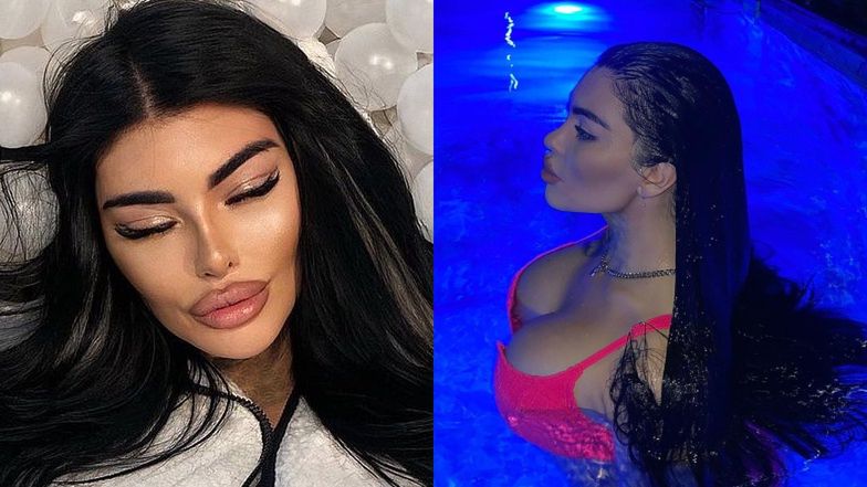 Królowe Życia. Anna Renusz chwali się nowymi piersiami