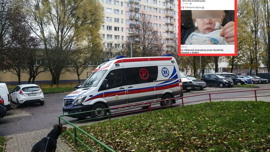 Roczny chłopiec pogryziony w żłobku przez dziewczynkę z innej grupy