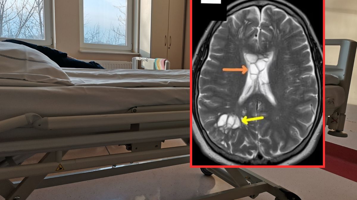Bolała go głowa. Lekarze znaleźli szokującą przyczynę.