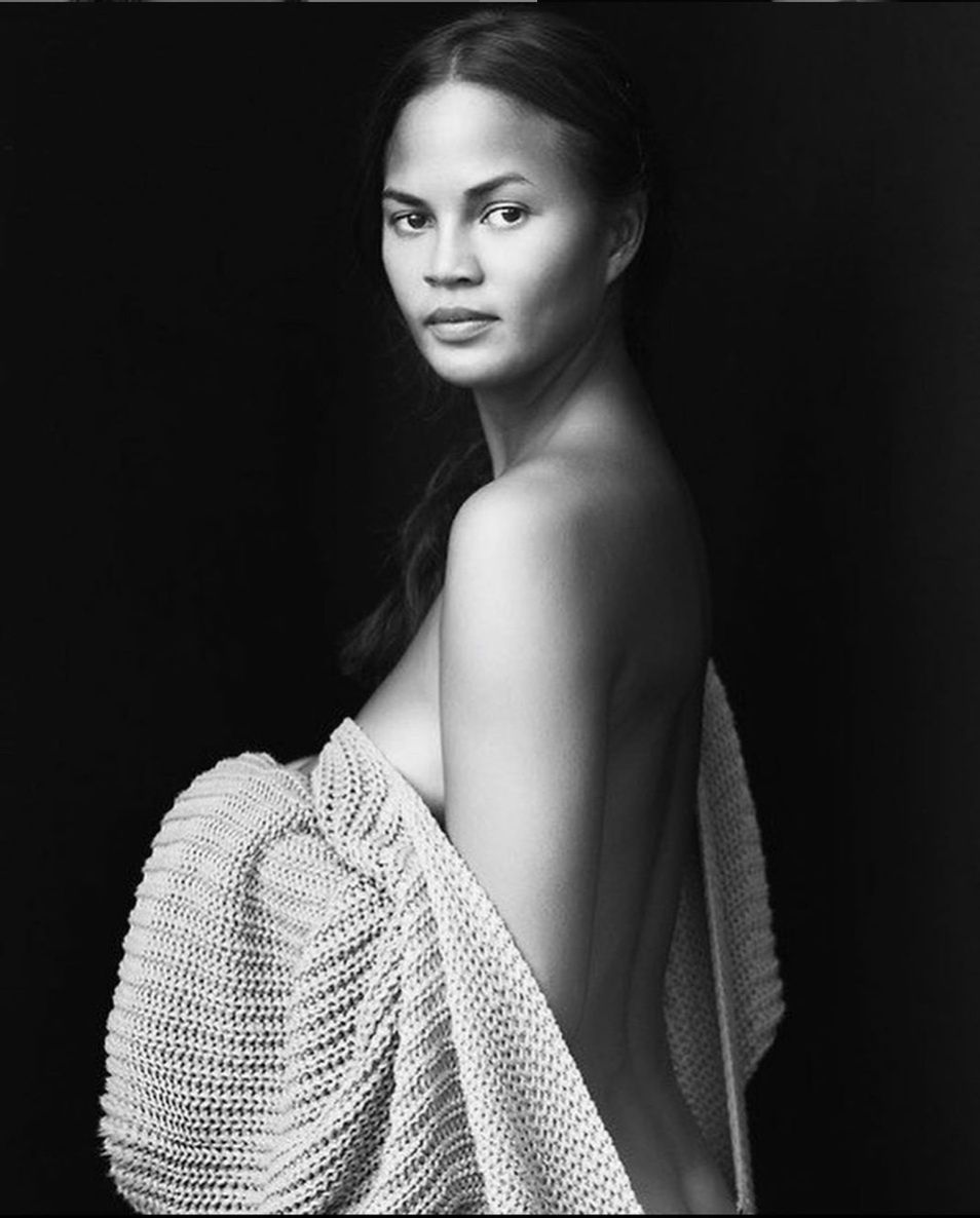 Chrissy Teigen zmniejsza piersi