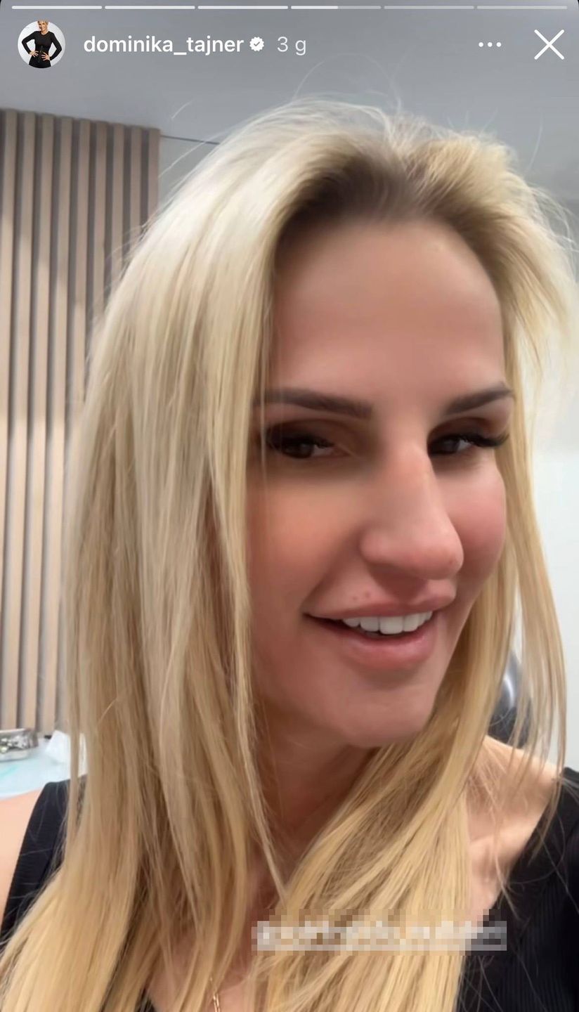 Dominika Tajner prezentuje nowy uśmiech 