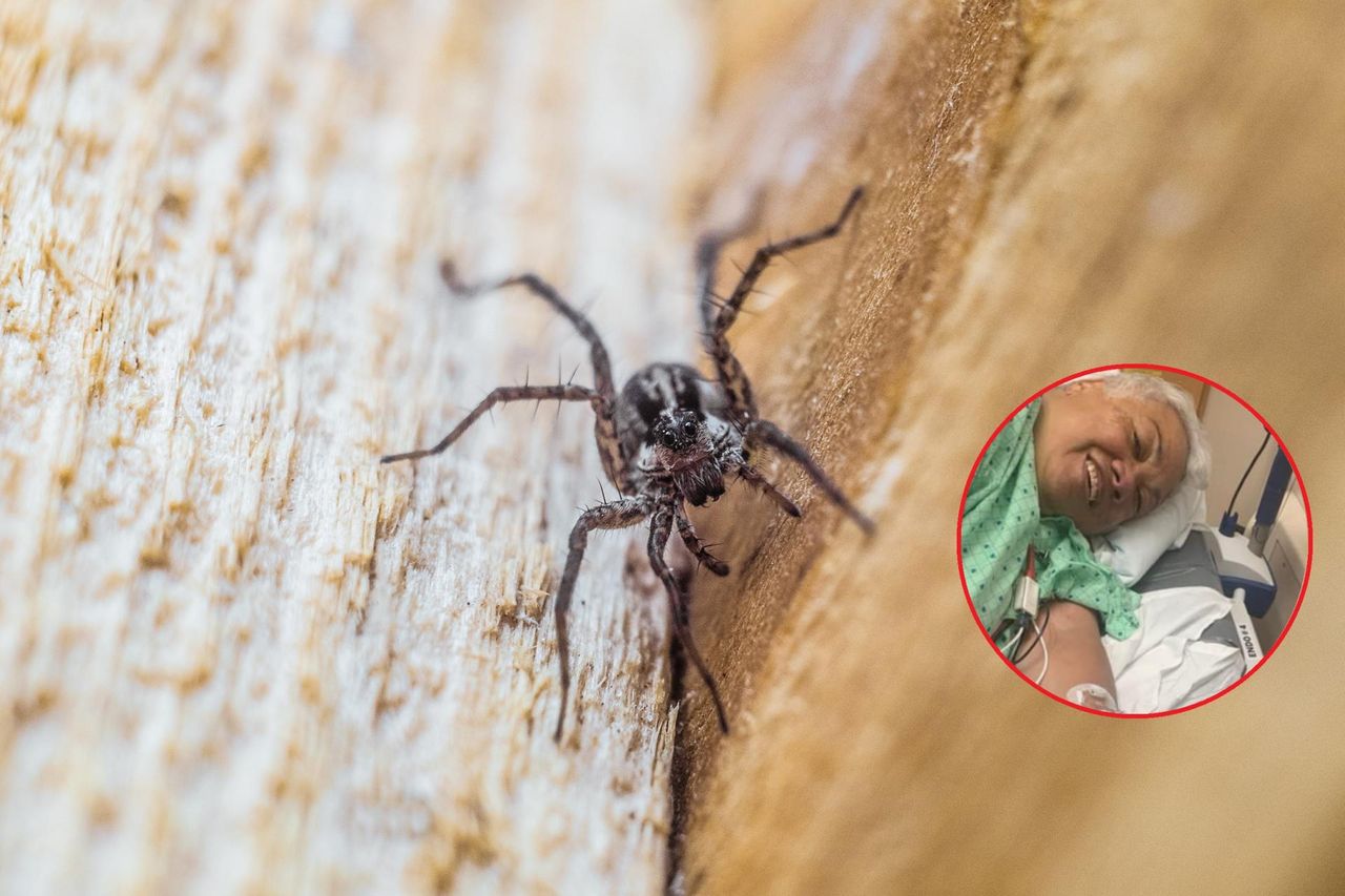 Bakteria "pożera jej ciało". Walczy o życie po pogryzieniu przez pająki