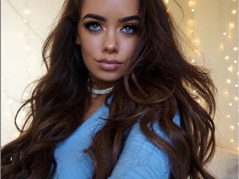 Cassidy Valentine powiększyła usta. Komplikacje po wstrzyknięciu kwasu hialuronowego prawie pozbawiły ją wargi