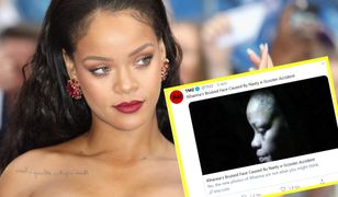 Wyciekło alarmujące zdjęcie. Rihanna ma pokiereszowaną twarz