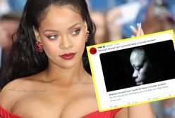 Wyciekło alarmujące zdjęcie. Rihanna ma pokiereszowaną twarz