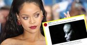 Wyciekło alarmujące zdjęcie. Rihanna ma pokiereszowaną twarz