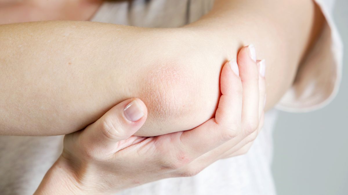 Jak pozbyć się suchości łokci? 