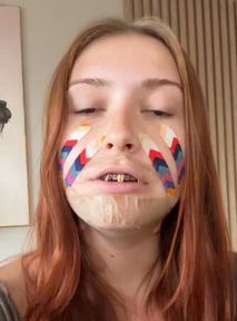 Murcix przeszła operację dwuszczękową. Wygląda jak postać z horroru