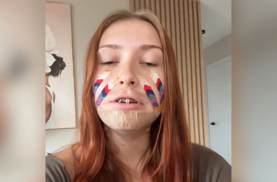 Murcix przeszła operację dwuszczękową. Wygląda jak postać z horr