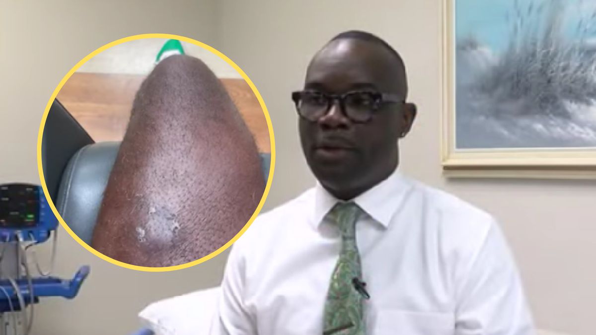 Mężczyzna dochodzi do siebie po ciężkim zabiegu