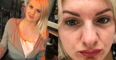 Uczestniczka programu "Projekt Lady" pokazała zdjęcie po operacji nosa: "Młodziej z nowym noskiem?"