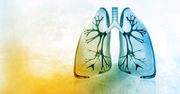 Zwapnienie płuc - przyczyny i objawy. Kiedy konieczne jest leczenie?