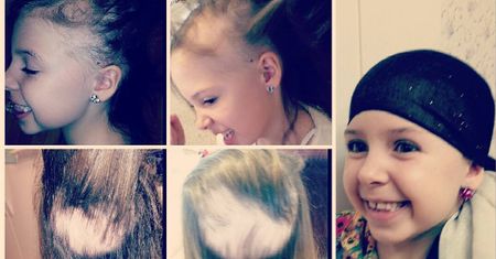 7-latka w miesiąc straciła wszystkie włosy. Mama znalazła rozwiązanie na pozbycie się jej kompleksów