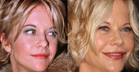 CO SIĘ STAŁO Z TWARZĄ MEG RYAN?!