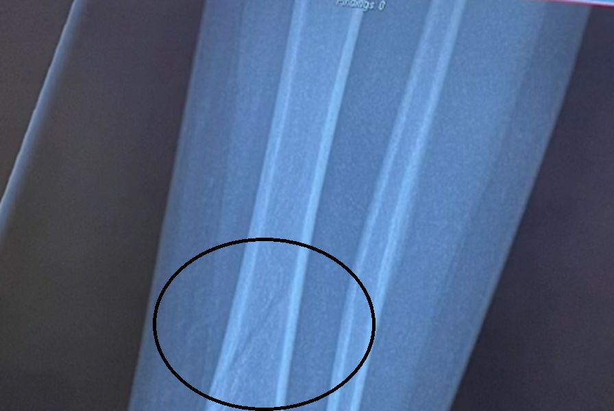 Zdjęcie RTG dwulatki