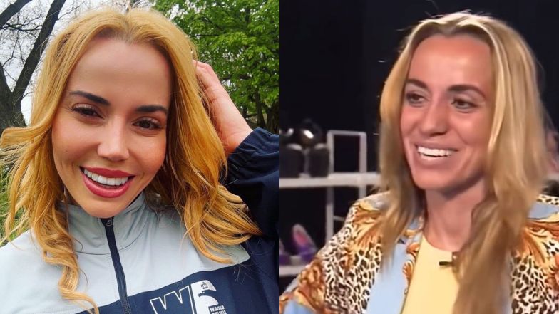 Marianna Schreiber zapytana o zabiegi medycyny estetycznej. Szczere słowa