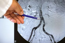 Choroby aorty – wrodzone i nabyte. Czy są groźne?