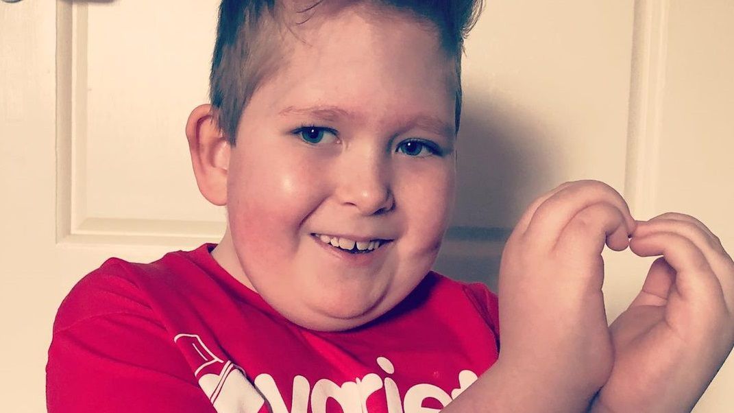 Urodził się z 2 proc. mózgu