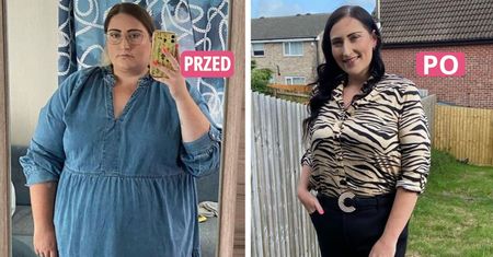 Schudła niemal 60 kilogramów. Przełożyła wesele i zdecydowała się na radykalny krok