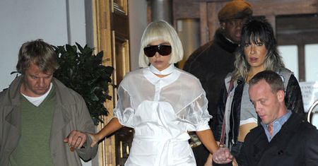 Poobijane nogi Lady Gagi!