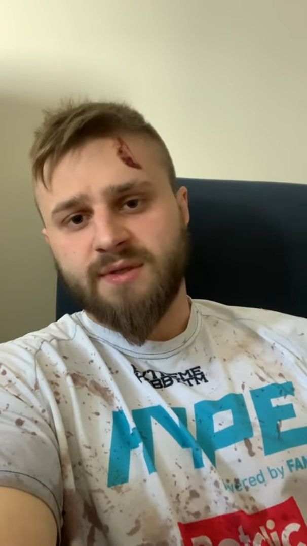 Gwiazdor Fame MMA został napadnięty we własnym domu?!