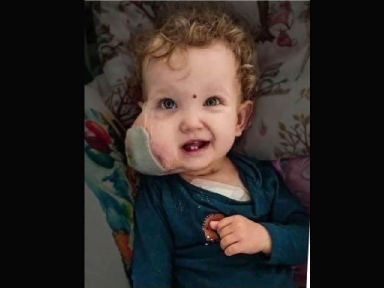 Dziewczynka upadła na policzek. Wtedy zaczął się koszmar