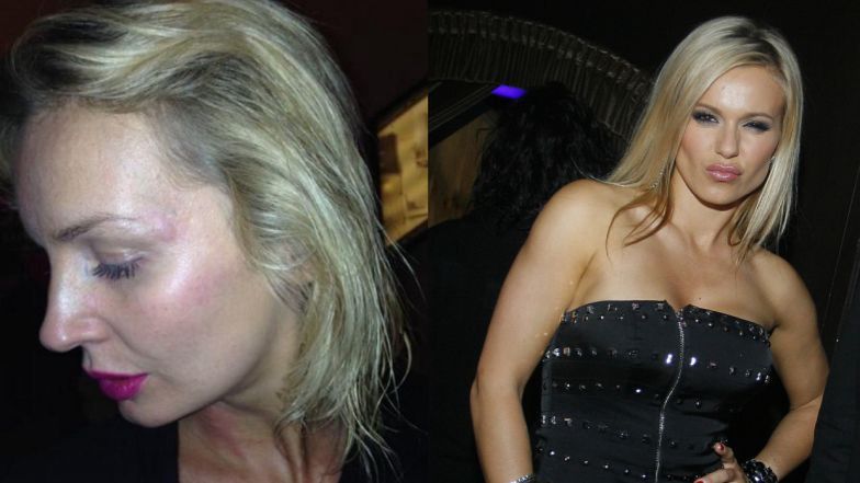 "Afera kiblowa", czyli Doda i Szulim szarpią się w toalecie