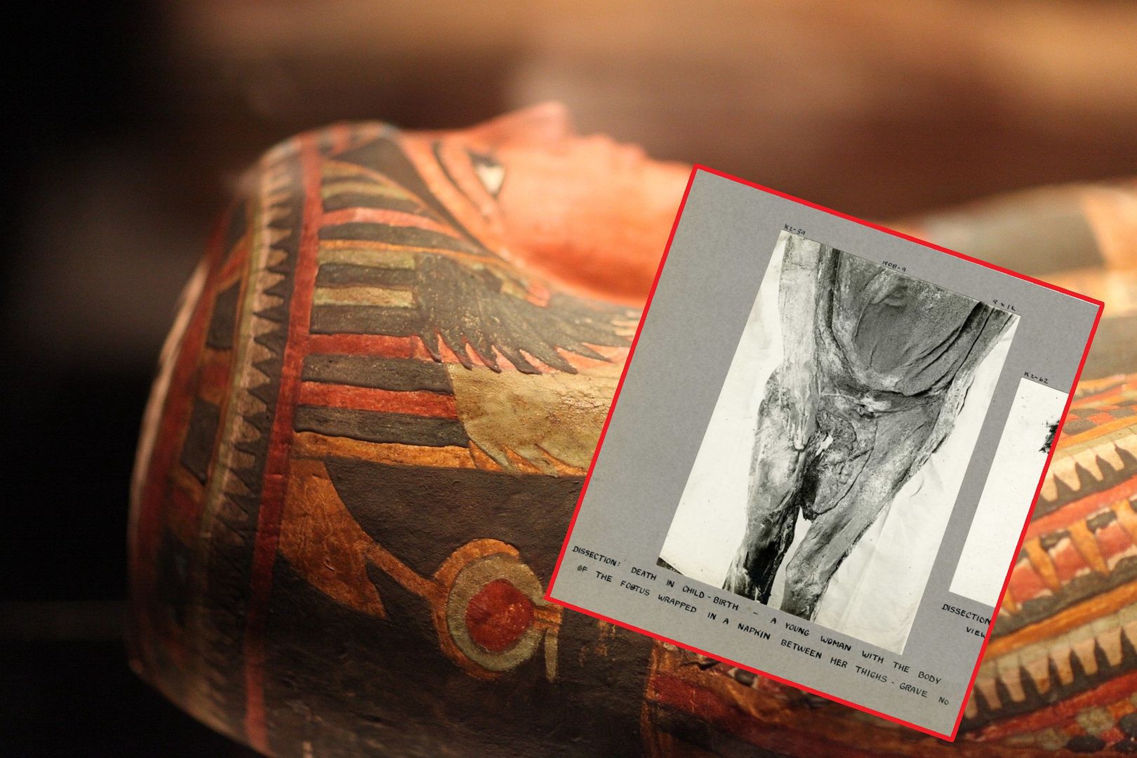 Odkrycie wewnątrz mumii nastolatki. Naukowcy byli zszokowani