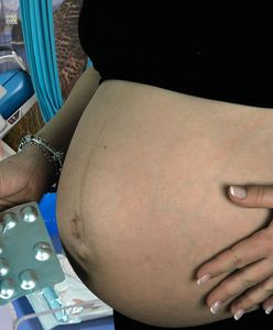 Polki będą rodzić na SOR-ach? W pomysł rządu nie uwierzył sam rzecznik rządu