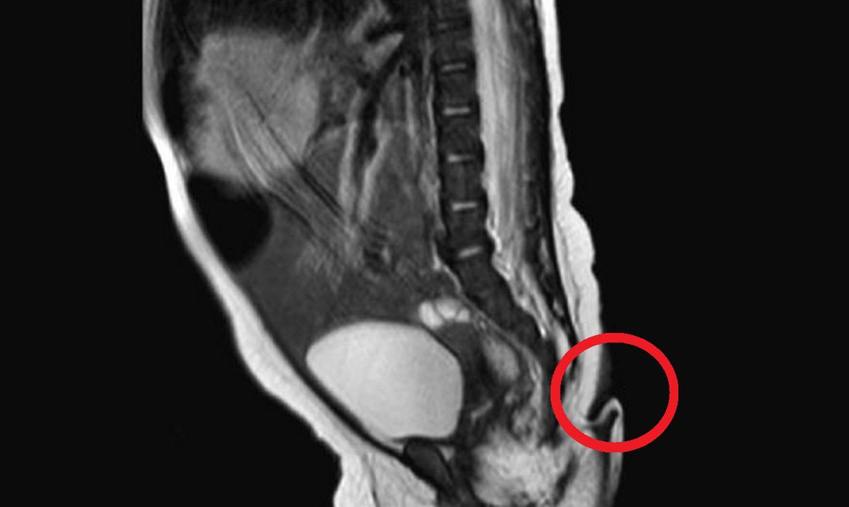 Niezwykła dziewczynka przyszła na świat. Mniej niż 200 przypadków w historii