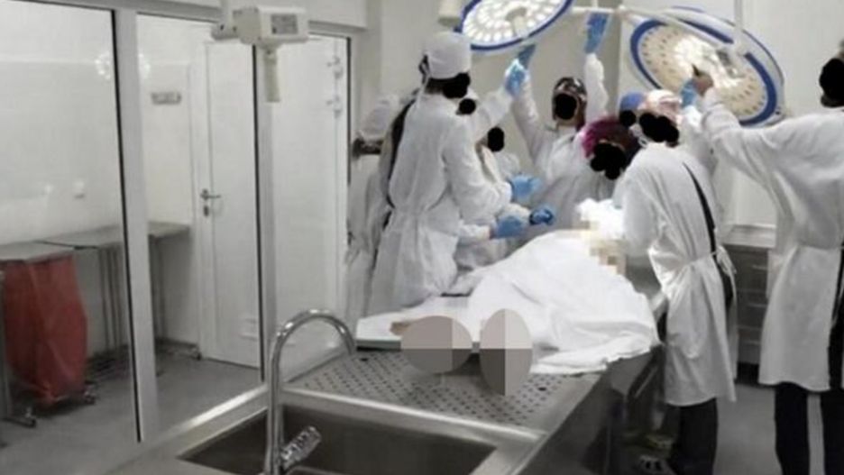 Szkoła wyższa zamieściła w sieci wideo z nowej pracowni anatomii. Decyzja wywołała oburzenie środowiska lekarskiego