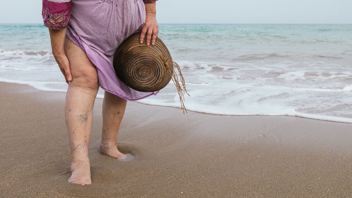 unrecognizable curvy senior woman with varicose veins on her legs wearing a purple dress, sunglasses and hat on the beach during her summer vacation.horizontal photo with copy space.
unrecognizable curvy senior woman with varicose veins on her legs wearing a purple dress, sunglasses and hat on the beach during her summer vacation.horizontal photo with copy space.
David Petrus Ibars