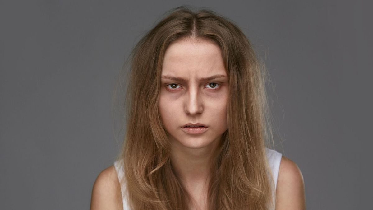 Cienie pod oczami jako jeden z objawów choroby