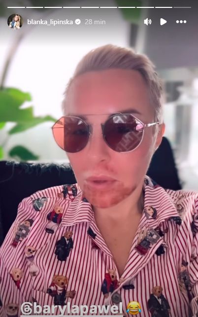 Blanka Lipińska poddała się kolejnemu zabiegowi