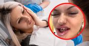 Nabrani na "tureckie zęby". Dentyści patrzą i nie wierzą