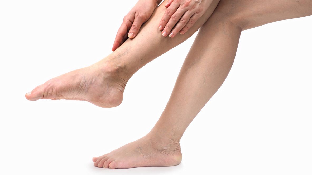 Uczucie ciężkich nóg może towarzyszyć nam bez względu na wiek