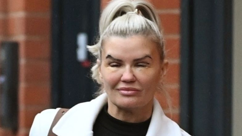 Kerry Katona przeszła kolejną operację plastyczną
