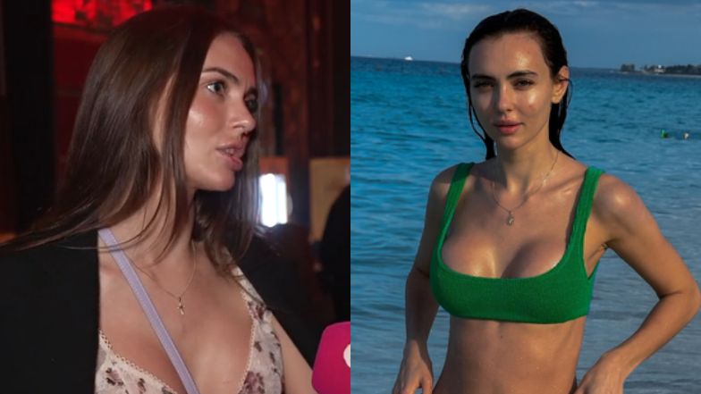 Leszczak o operacjach plastycznych: "Miałam za duże usta"