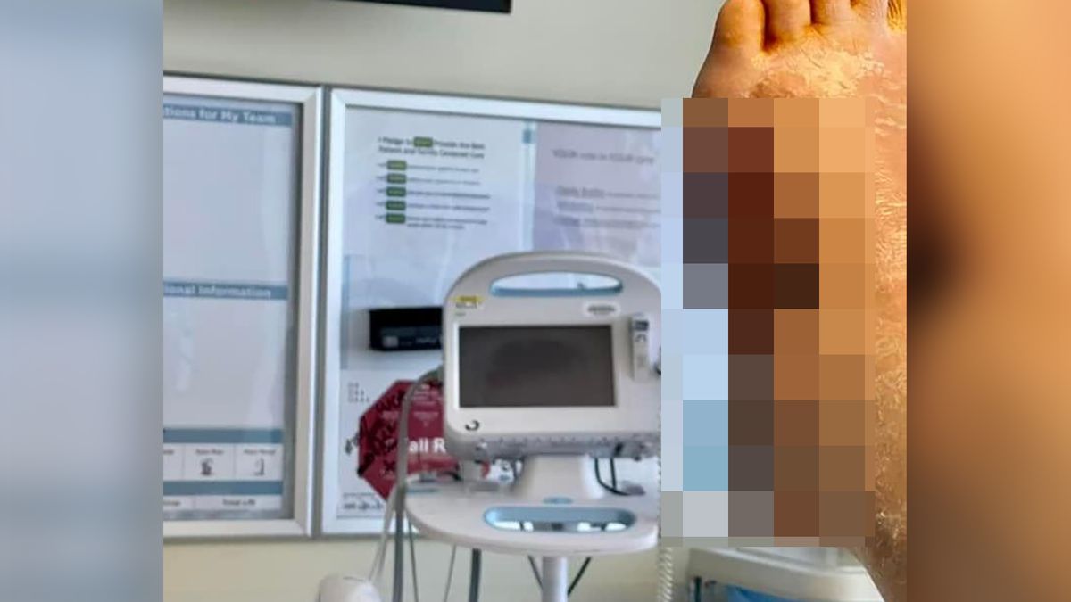 Może stracić nogę. Powodem jest bezmyślne selfie 1