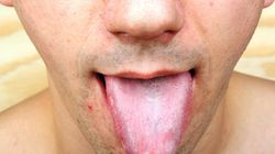 Niedoceniane części ciała. Mogą wiele zdradzić na temat kondycji zdrowotnej