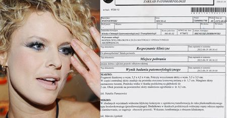 Mandaryna: "Na wszelki wypadek SKONTAKTUJĘ SIĘ Z LEKARZEM!"