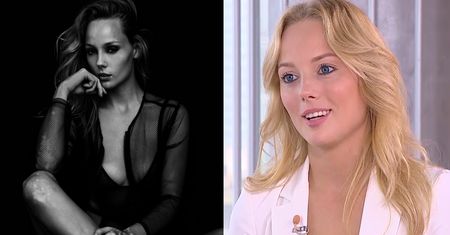 Modelka z bielactwem o "Top Model": "Byłam jedną z lepszych twarzy edycji. Nie zgadzam się z werdyktem!"