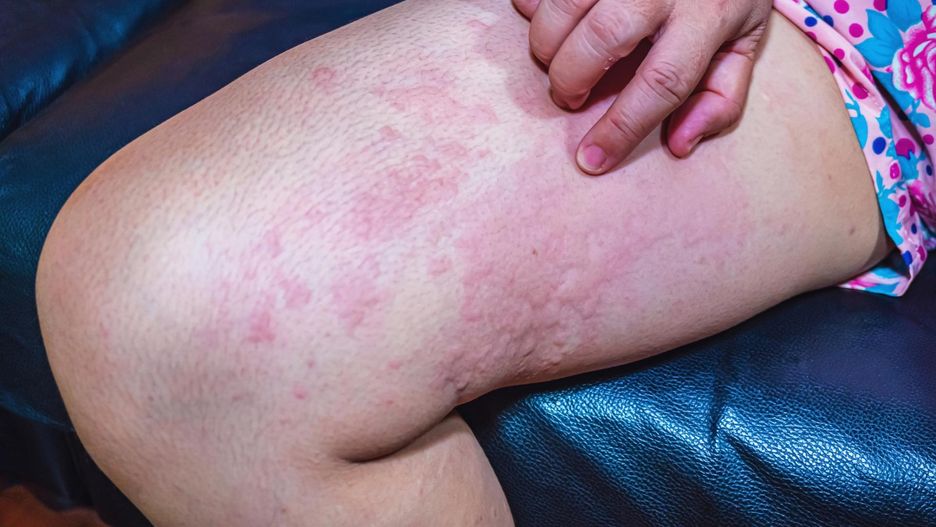 Coraz więcej chorych. "To coś naprawdę przerażającego"