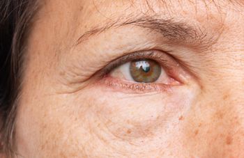 Pożegnaj opuchliznę twarzy. Efekt zobaczysz w lustrze od razu