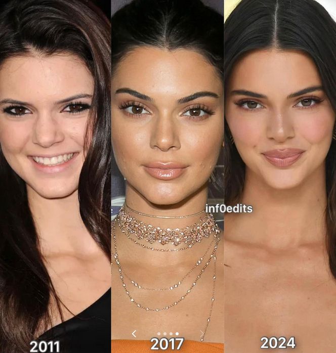 Tak na przestrzeni lat zmieniała się Kendall Jenner
