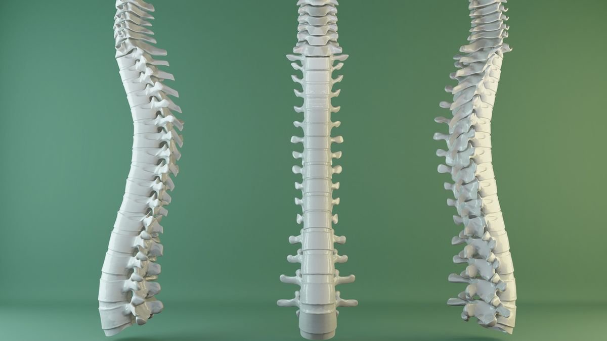 Operacja złamania kręgu nie należy do rzadkości, szczególnie w społeczeństwie starzejącym się.