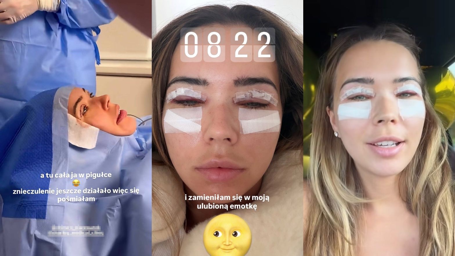 Sandra Kubicka dokumentuje rekonwalescencję po operacji